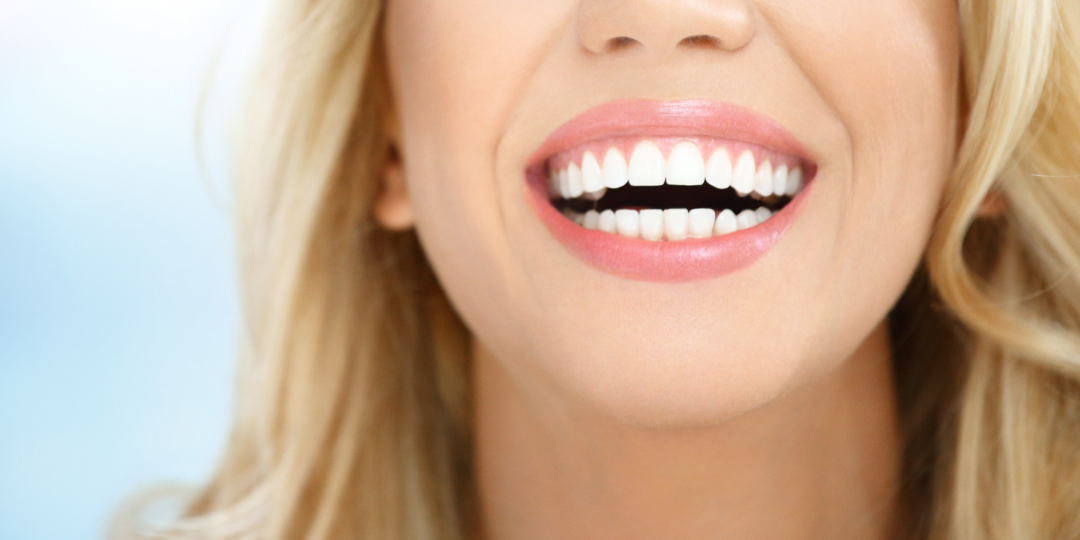 İzmir Hollywood Smile ile Kusursuz ve Doğal Bir Gülüş
